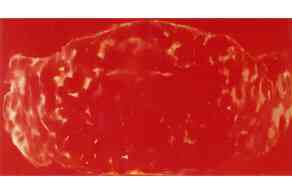 frederic_zangrandi_homard_segment_2_2002_huile_sur_toile_110x60_cm