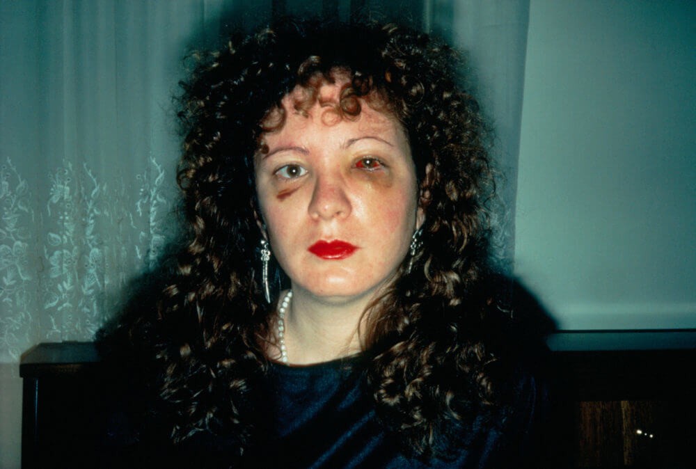 nan_one_month_after_being_battered_1984_silver_dye_bleach_print_printed_2008_moma_new_york__2016_nan_goldin